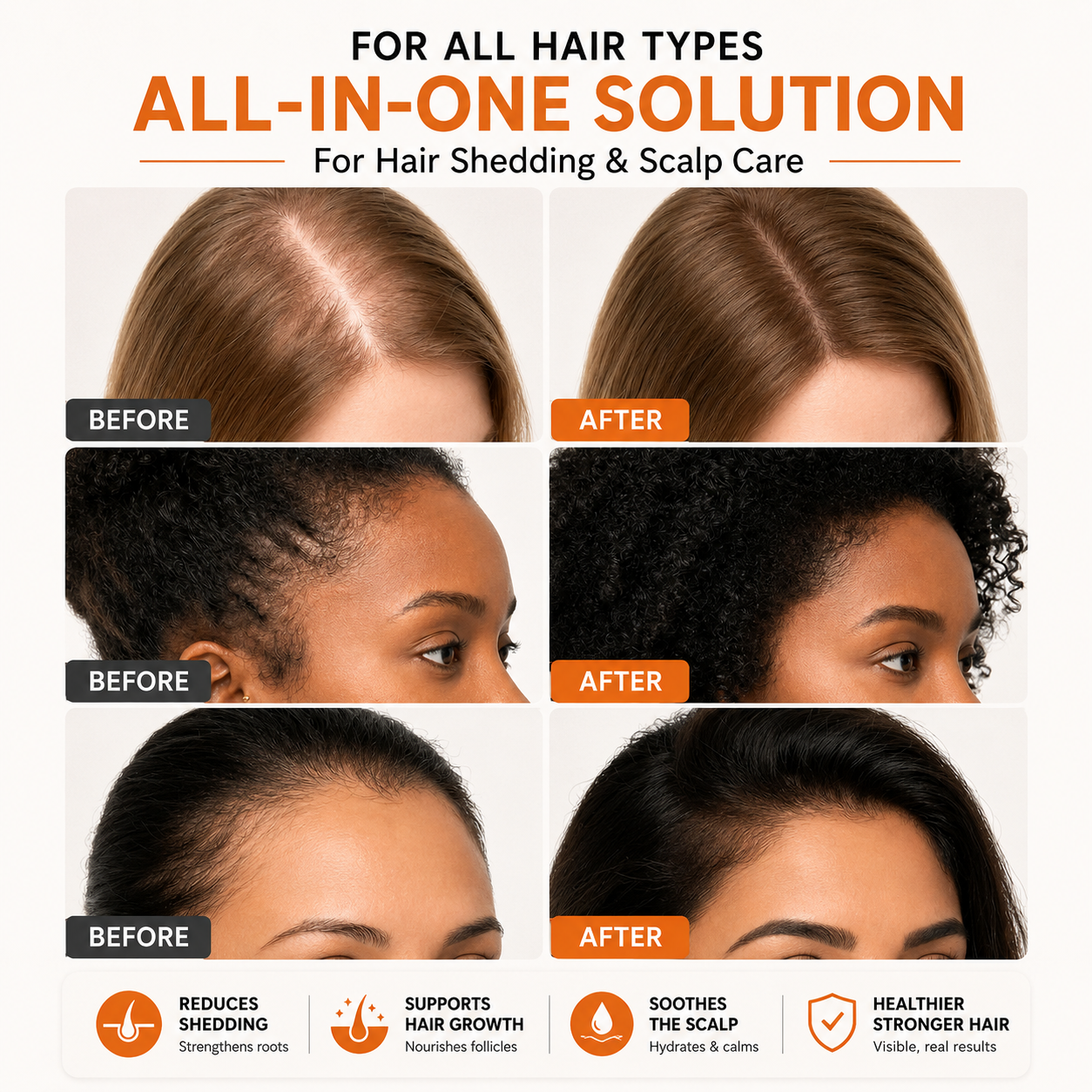 Korea’s #1 Hair Growth Serum for Thinning Hair & Scalp Health